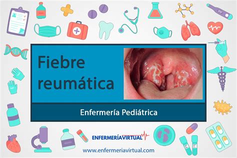 Fiebre reumática - Enfermería Virtual