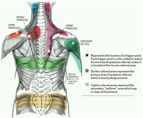 Back Trigger | Trigger points, Trigger point therapy, Trigger point massage