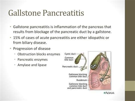 PPT - Clinical Case Study: Acute Pancreatitis PowerPoint Presentation - ID:3144043