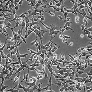 Red Fluorescent HEK-293 Cell Line - Innoprot Stable Cell Lines