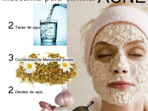 Klassifizieren Wachstum Feder mascarillas caseras para el acne Angemessen Zuschauer Mm