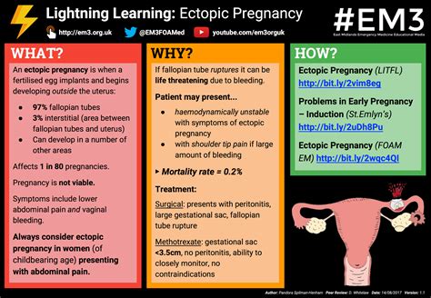 Lightning Learning: Ectopic Pregnancy — #EM3: East Midlands Emergency Medicine Educational Media