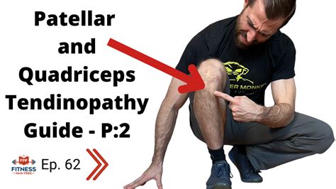 Patellar and Quadriceps Tendinopathy: Evidence Based Guide – Diagnosis, Differential Diagnosis ...