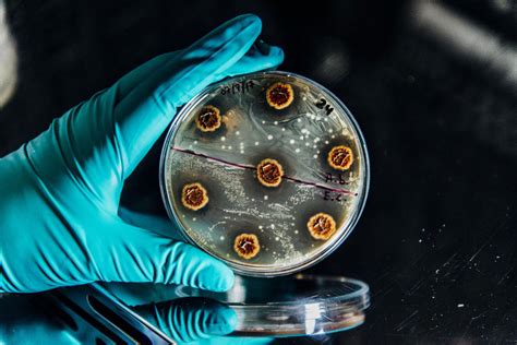 New Discovery Will Help Limit the Development of Antibiotic Resistance