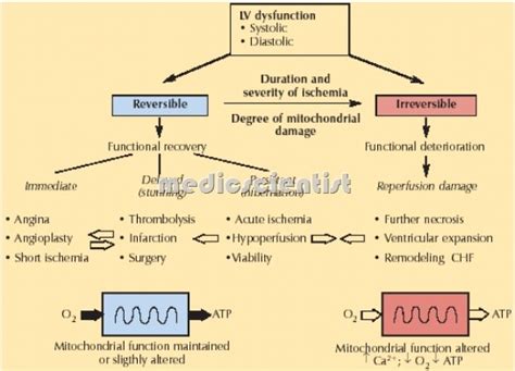 Ischemia Myocardial ischemia(MI) ECG and effects of ischemia ...