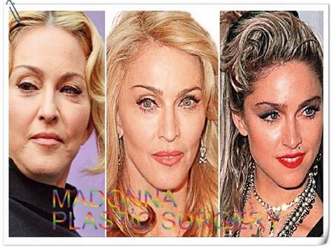 madonna plastic surgery | Plastic surgery, Bad plastic surgeries ...