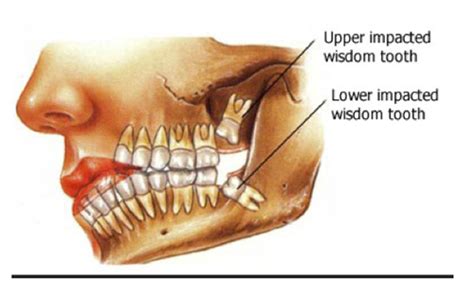 School of Dentistry - LSU Health New Orleans