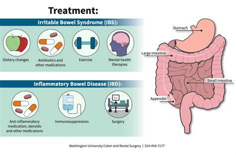 Inflammatory Bowel Disease or Irritable Bowel Syndrome? | Department of ...