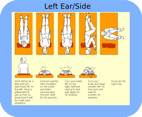 EPLEY MANEUVER INSTRUCTIONS PDF