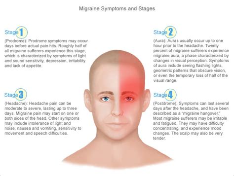 Migraine Symptoms, Causes and Treatments | MyBrainTest