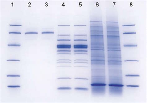 How can gel electrophoresis be used to detect mutations? | Socratic