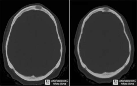 Welcome to LearningRadiology