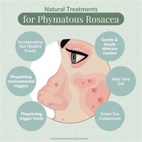 Type 3 Phymatous Rosacea Nose & Face Symptoms + Proven Treatment