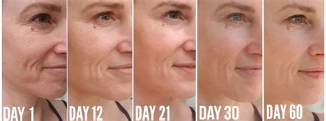 Collagen Before and After Pictures - Do you see the Difference?
