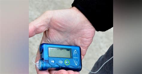 New insulin pump with control technology launched in U.S. | Healthcare ...