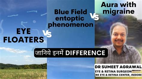 यह चीज़ें eye floaters जैसी दिखती हैं पर होती नहीं l Blue field entoptic phenomenon / Aura ...