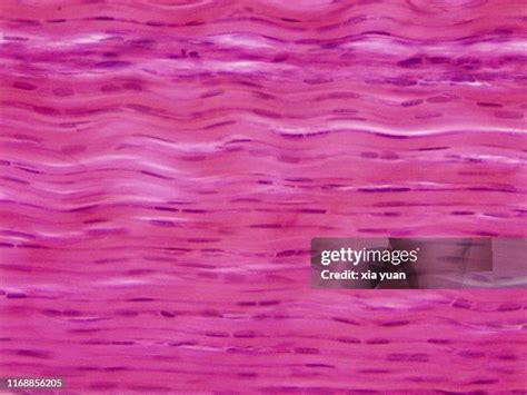 39 Collagen Fibers Histology Stock Photos, High-Res Pictures, and Images - Getty Images