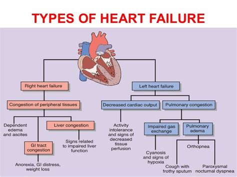 Heart failure-treatment-options-india