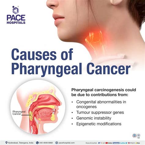 Pharyngeal cancer - Causes, Symptoms, Stages, Prognosis