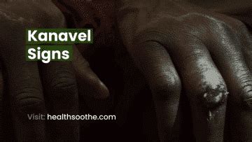 Kanavel's Signs: Key Indicators And Treatment Approaches