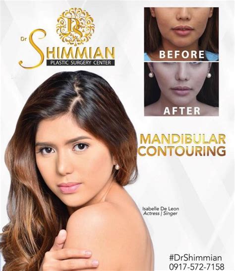 Malar Bone Reduction Combined With Mandibular Contouring - Dr Shimmian Aesthetic Center