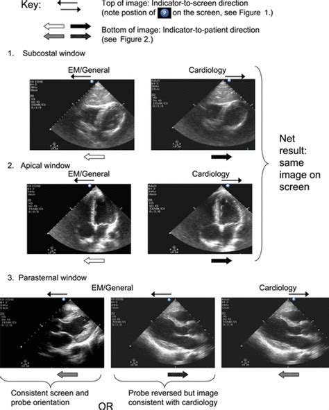 Scanning School - Cardiac — Taming the SRU