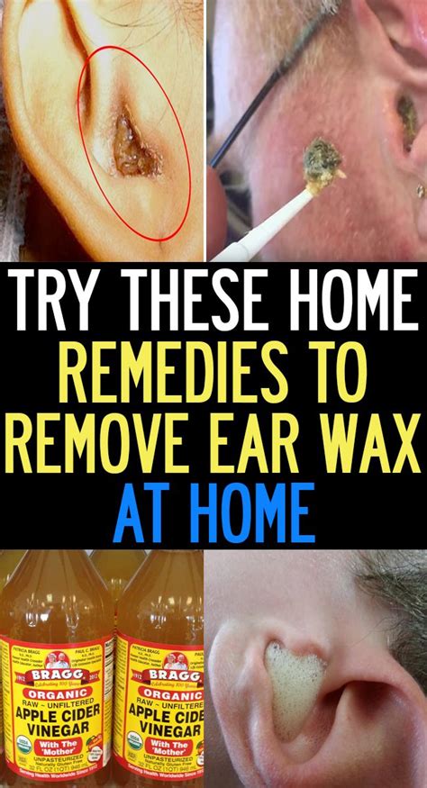 Natural Home Remedies To Remove Ear Wax At Home : Quick Look | Natural ear infection remedy, Ear ...