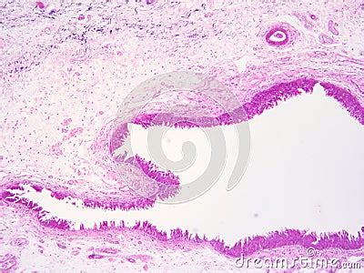 Histology Of Epiglottis Human Tissue Stock Photography | CartoonDealer.com #147729164