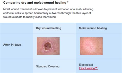 Which will heal faster, a cut which is covered or uncovered? - Quora