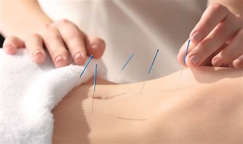 Acupuncture Courses – Details, Eligibility, Fees, and Career - Custom ...