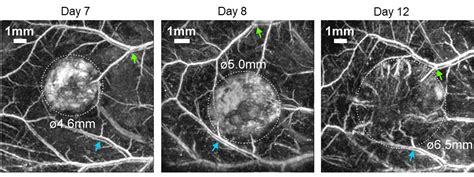 Photoacoustic Imaging | Centre for Advanced Biomedical Imaging - UCL ...