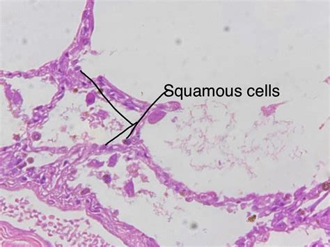 Epithelium Histology Simple Squamous Epithelium Label - vrogue.co