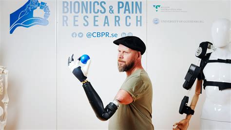 This Prosthetic Limb Actually Attaches to the Wearer’s Nerves - 'Wired ...