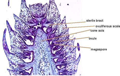 Female Pine Cone (C.S.) | Plant Cell Images