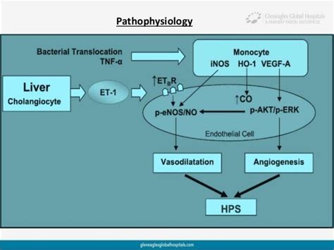 Hepatopulmonary syndrome by Albin Joseph