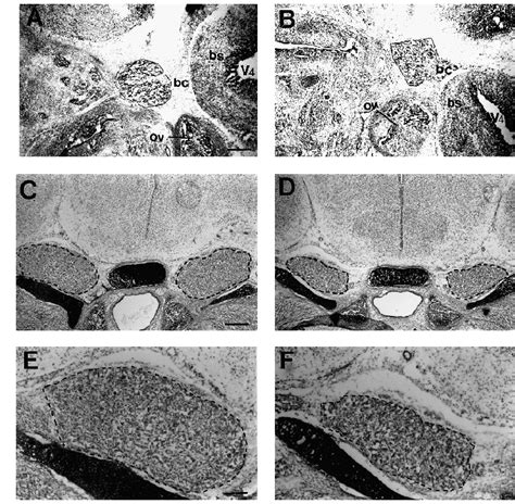 Trigeminal Ganglion Histology