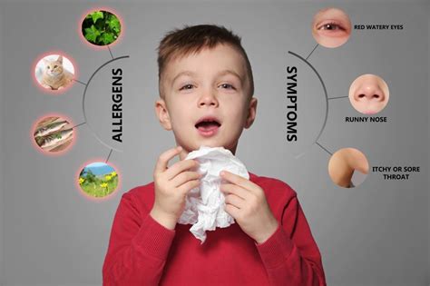 UAE: Why childhood food allergies are on the rise - and how to prevent them | Parenting-child ...