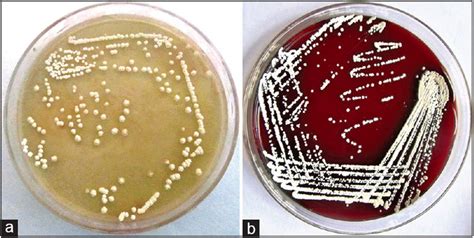 Blood Agar vs Nutrient Agar- Know Your Agar Plates - Advancells Group