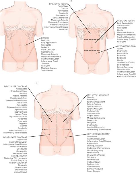 Figure 2 from II COMMON PRESENTING PROBLEMS ACS Surgery : Principles ...