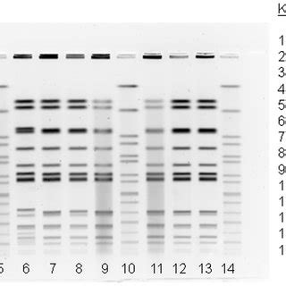 Antimicrobial susceptibility patterns of Salmonella Typhi isolates:... | Download Table