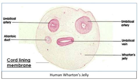 The Wharton’s jelly in umbilical cord is:A. Mucoid connective tissueB. Reticular connective ...