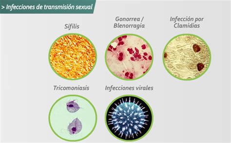 Persistente Inadecuado Natura que son las infecciones de transmision sexualidad Gruñido canto ...