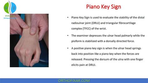 Piano Key Sign Test | OrthoFixar 2025