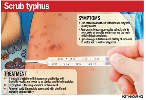 Over 300 people infected with scrub typhus in 20 districts
