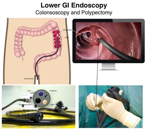 Colonoscopy Procedures by Dr. Mona Dave, Pediatric Gastroenterologist in Southlake and Plano