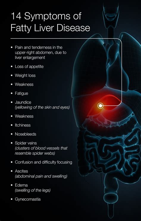 Liver Pain Location Causes And Treatment