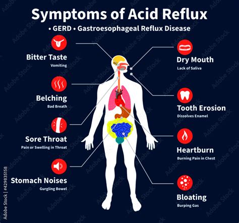 Fototapeta Symptoms of Acid Reflux, GERD, gastroesophageal reflux disease, Heartburn, chronic ...