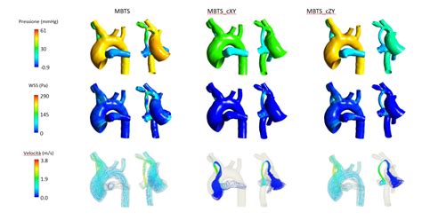 Cloud-Based HPC Platform to Support Systemic-Pulmonary Shunting Procedures