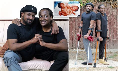 Conjoined Twins Married To One Man