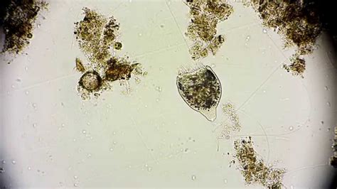 Protist - rhabdostyla ovum - Ciliophora - microorganisms under ...